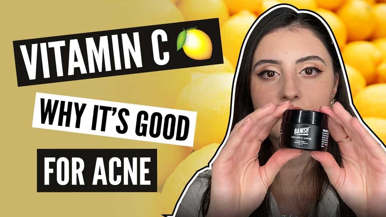 How Vitamin C Helps with Acne and Acne Scars