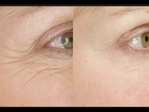 How Wrinkles Form & How to Prevent Them | PERFECT BEAUTY