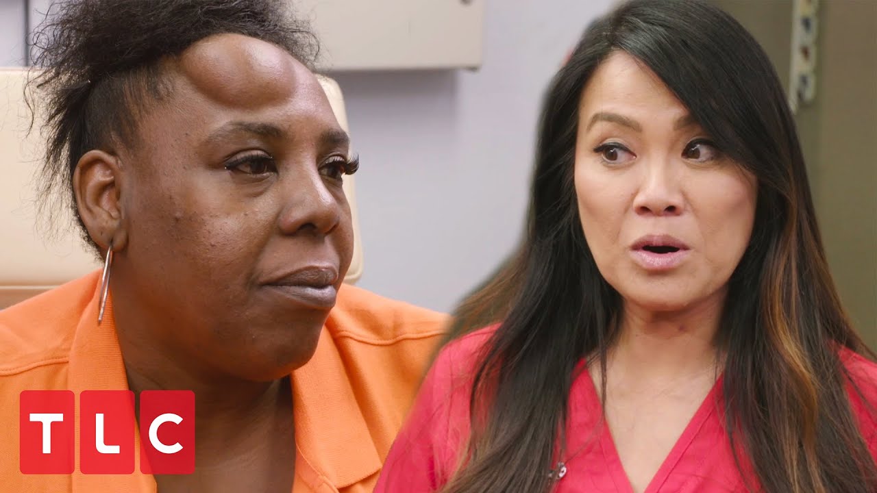 Huge Bump on Her Forehead | Dr. Pimple Popper: Season’s Squeezings
