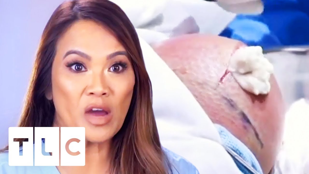I Can’t Watch! | Dr. Pimple Popper