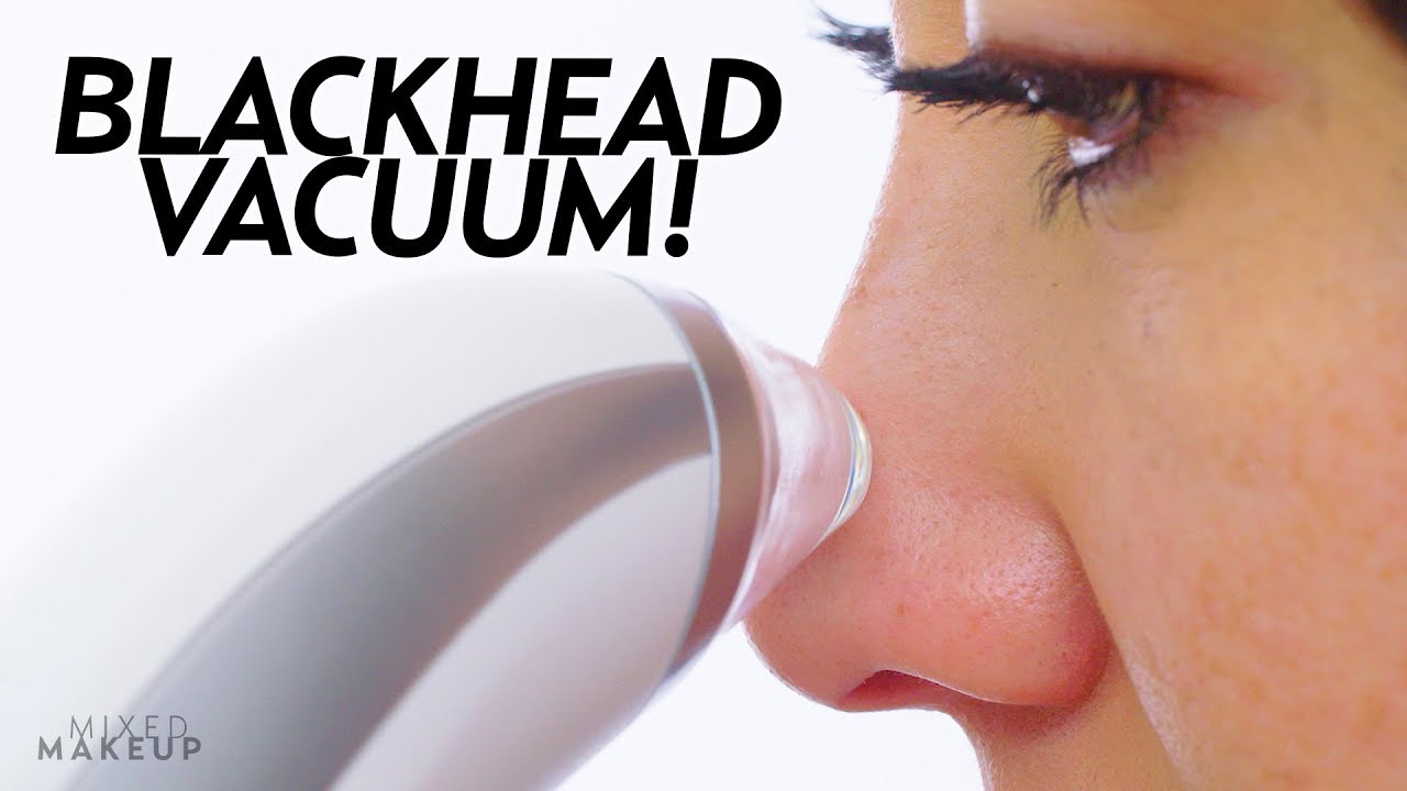 I Tried a Blackhead Remover Pore Vacuum! | Beauty with Susan Yara