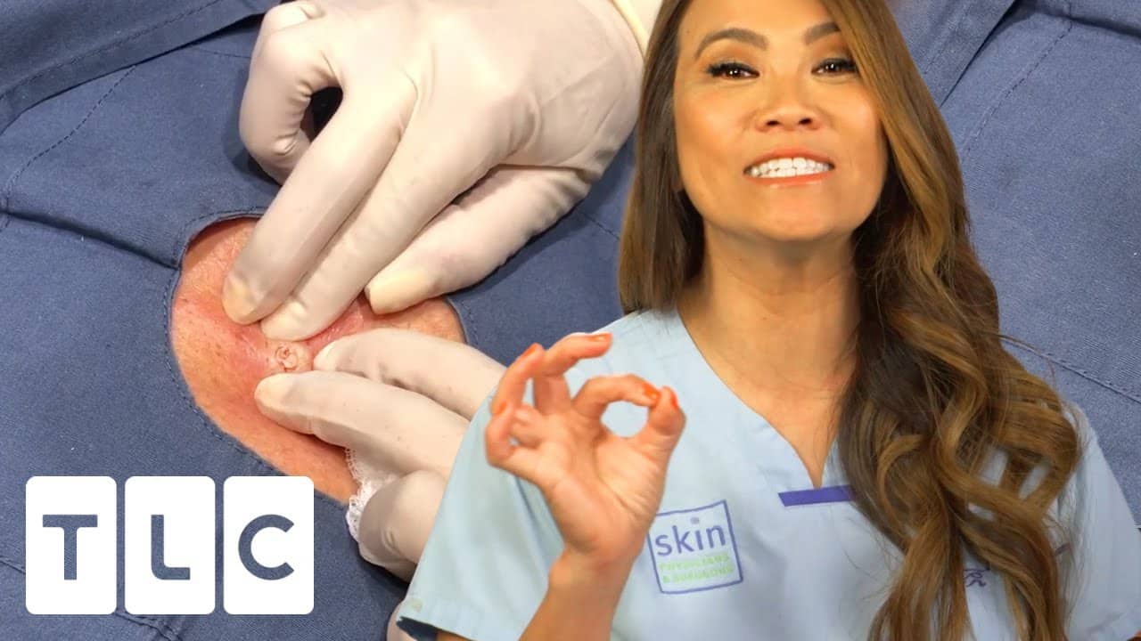 "I'm Like a Cyst Sleuth" Dr Lee Investigating Deep Epidermoid Cysts | Dr. Pimple Popper: This Is Zit