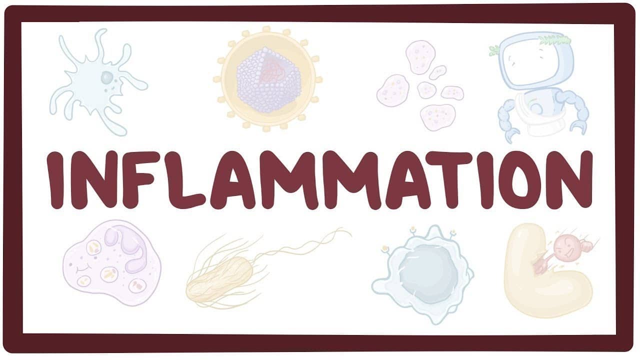 Inflammation – causes, symptoms, diagnosis, treatment, pathology