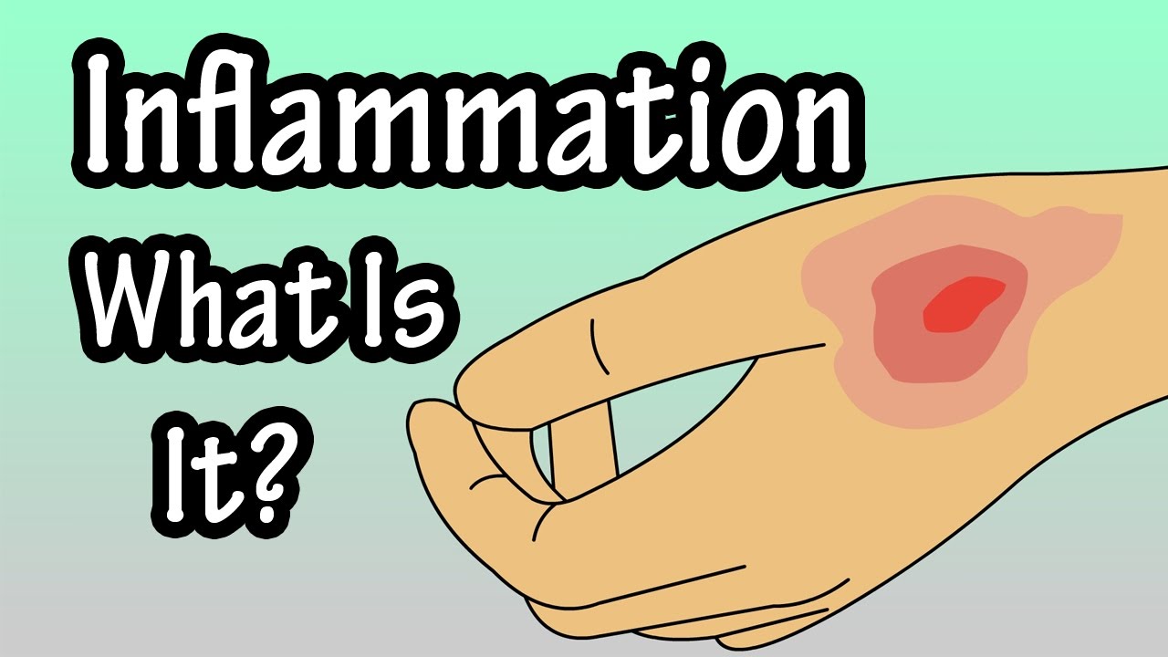 Inflammation – Inflammatory Response – What Is Inflammation In The Body?