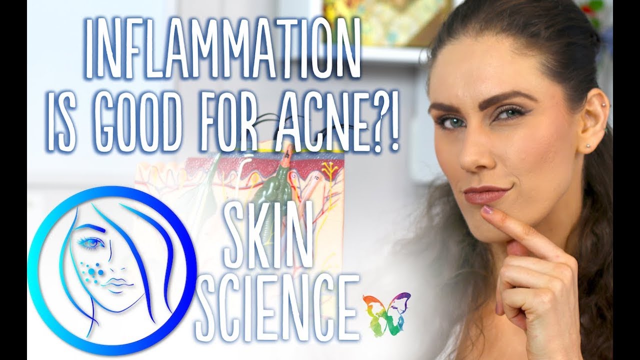 INFLAMMATION: THE 4 STEPS OF WOUND (& ACNE) HEALING | Skin Science Episode 7