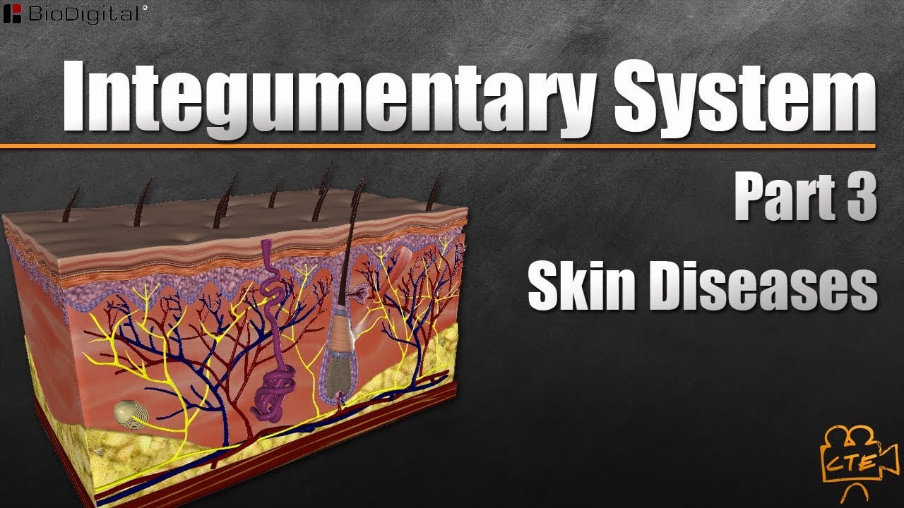 Integumentary System Part 3 (Part 3 Of 3) (Skin Diseases)