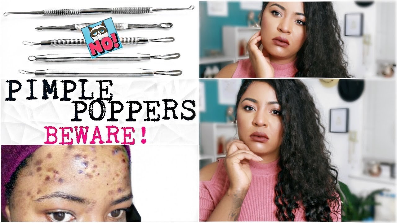 Is Dr Pimple Popper Right?..Too Melanated For Pimple Popping Y'all