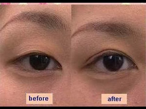 Japanese Koji Eye talk double eyelid glue review