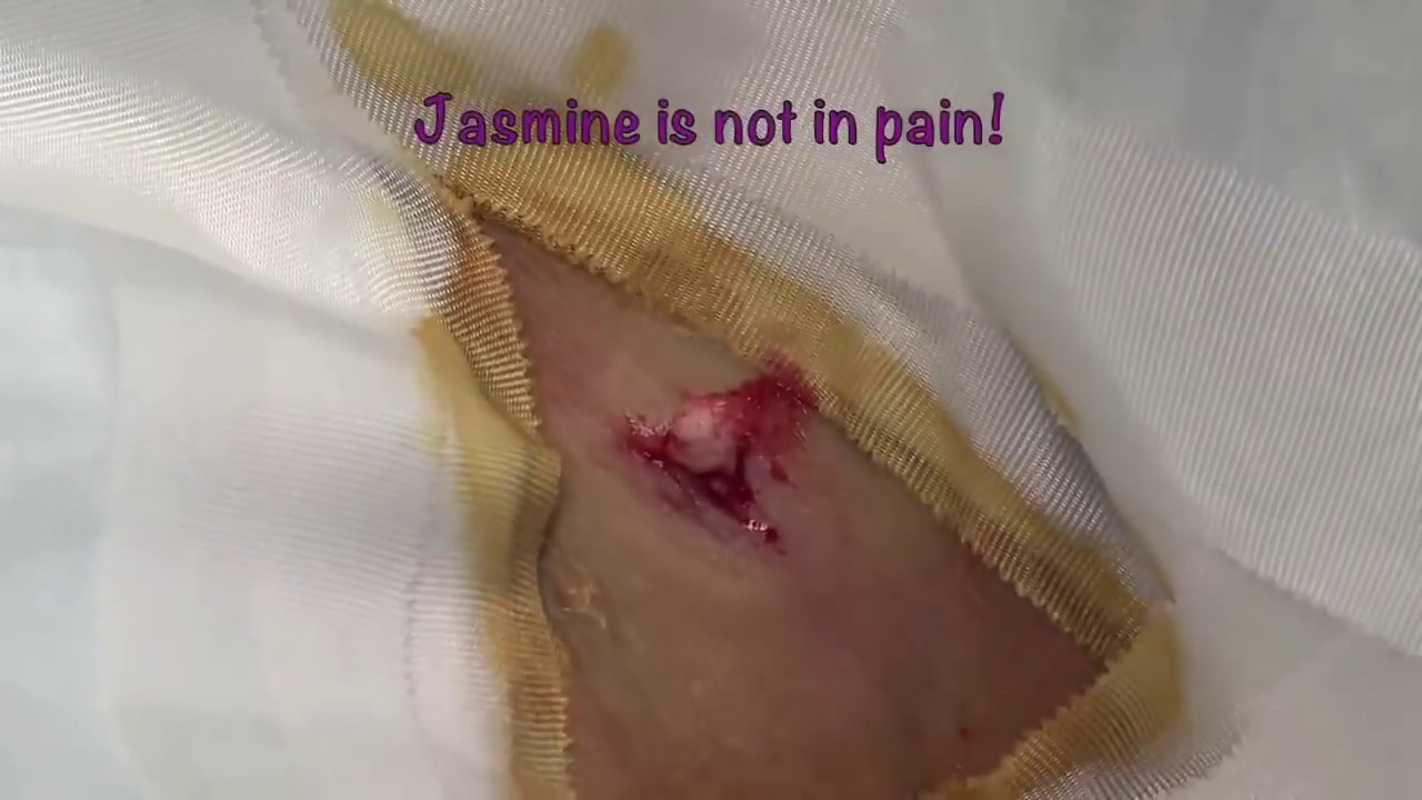 Jasmine Neck Cyst, Can She Handle it?