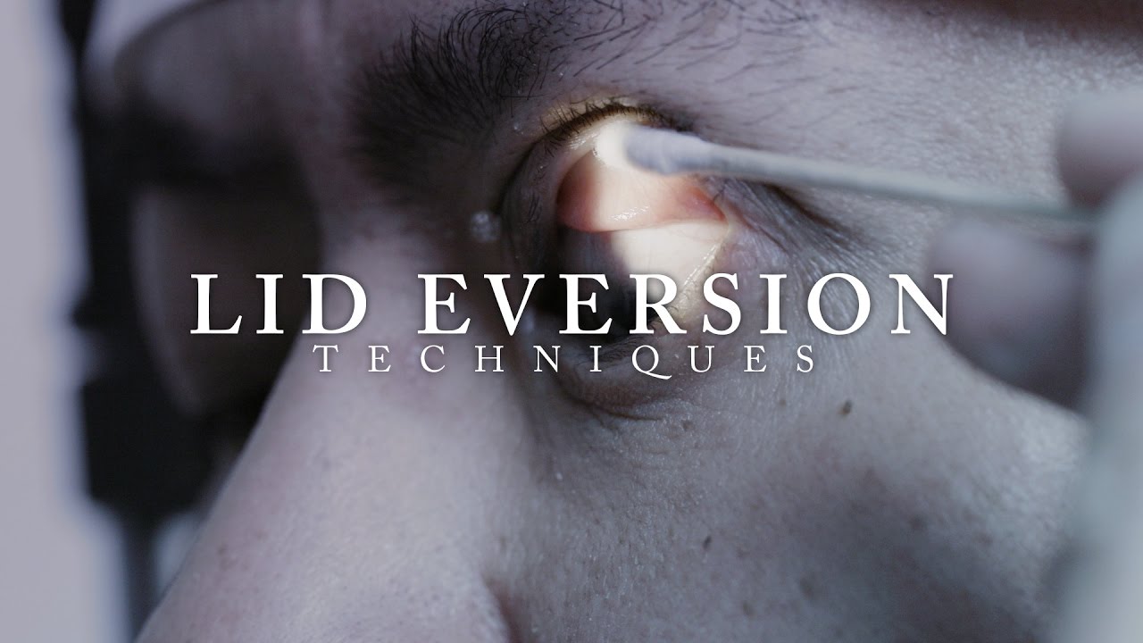 Lid Eversion – OPHTHALMOLOGY – Ep 9