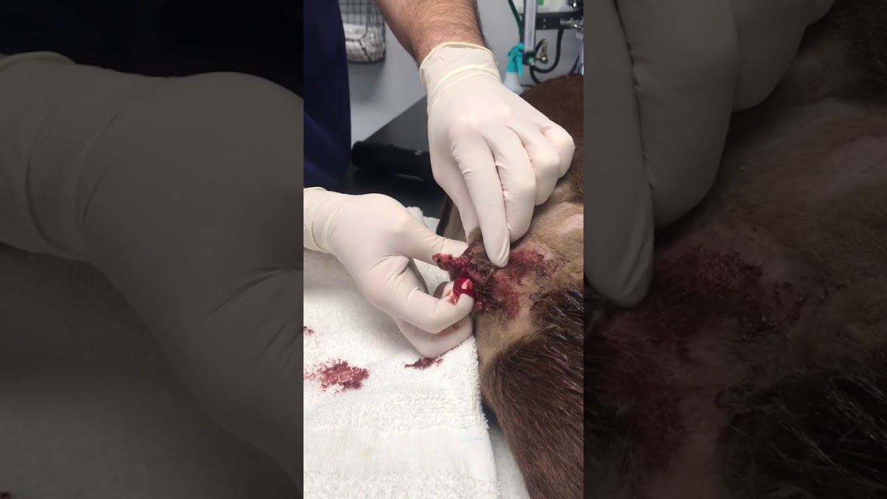 Lily’s Cyst gets popped