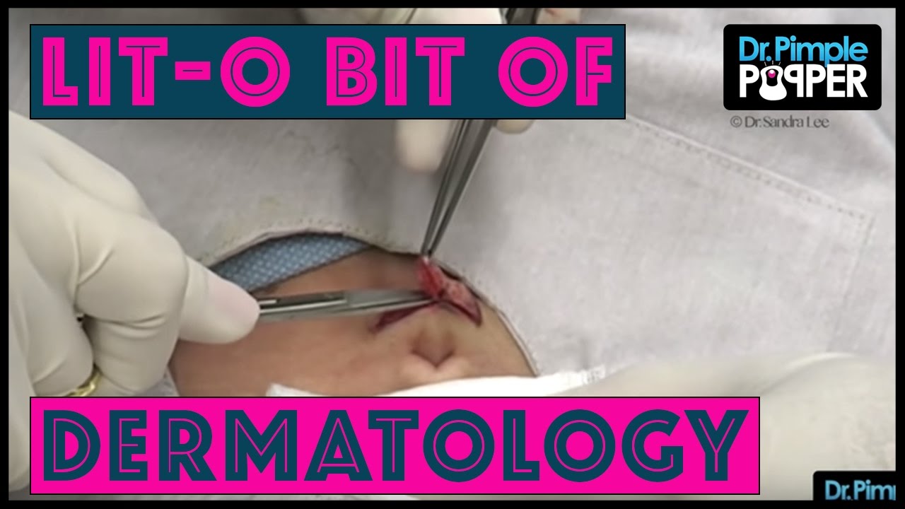 Lit-O Bit of Dermatology – This and That…