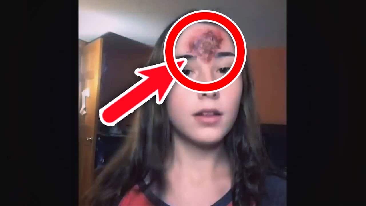 Major satisfying Pimple Popping moments 2021 – Part 18