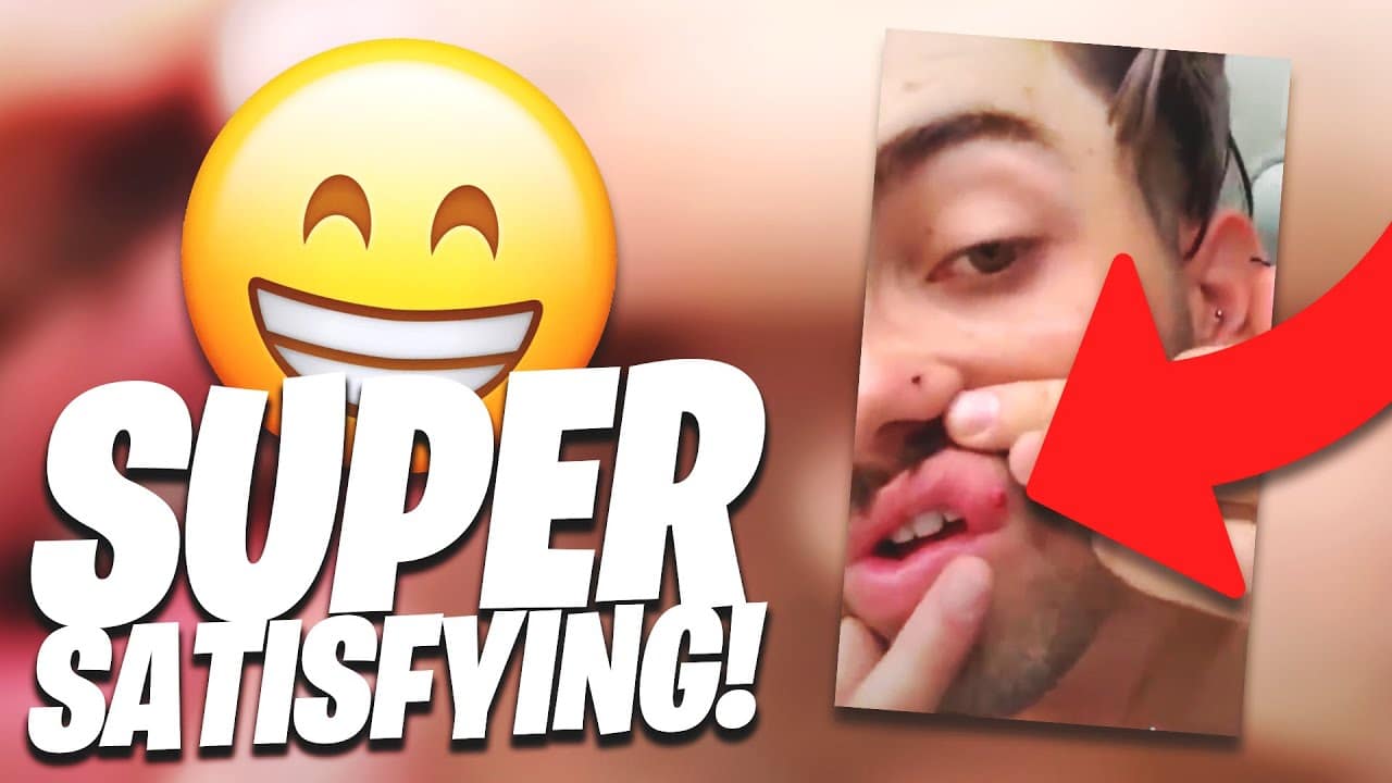 Majorly Satisfying Dr. Pimple Popping Moments of 2020! (PART 1)