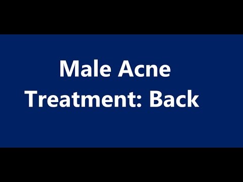 Male Acne Treatment: Back