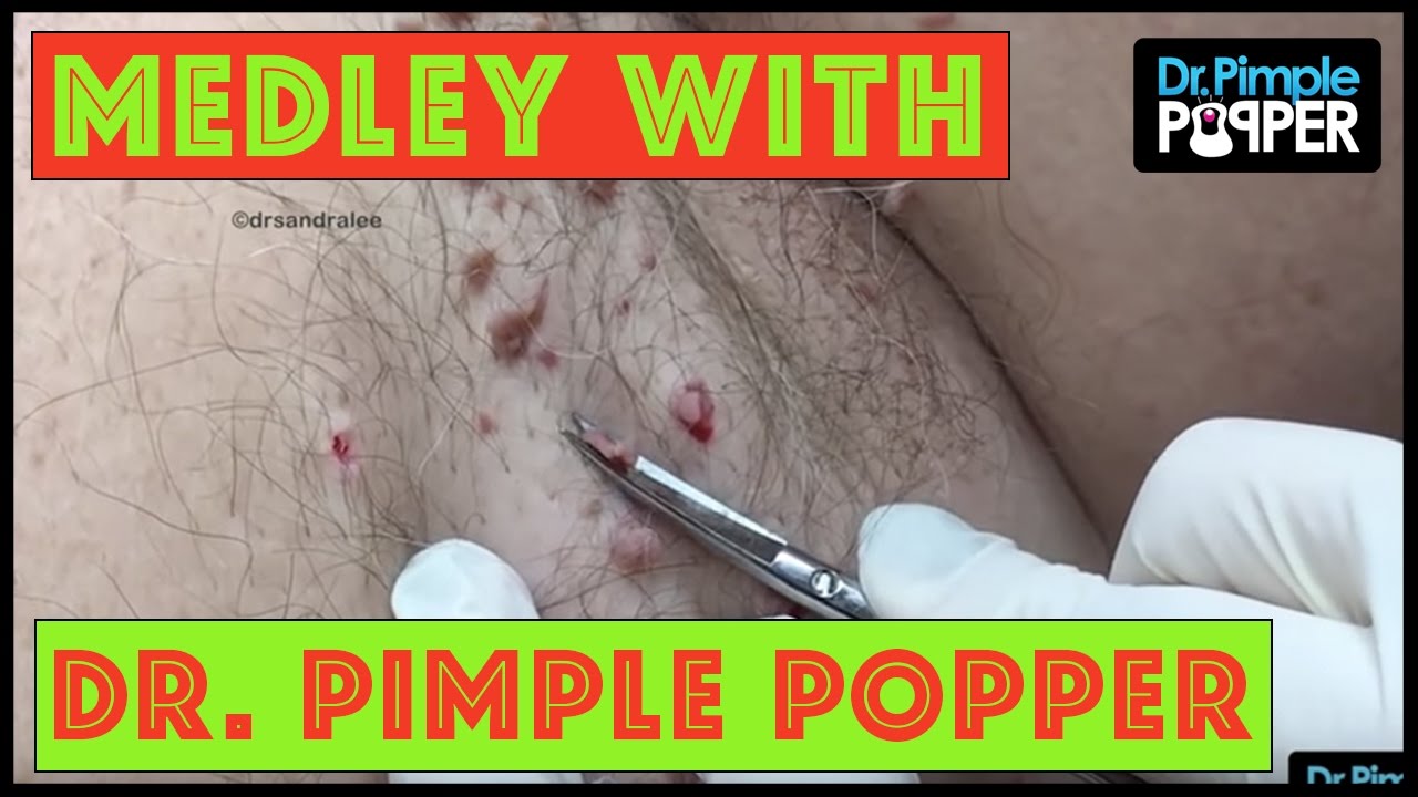Medley with Dr. Pimple Popper