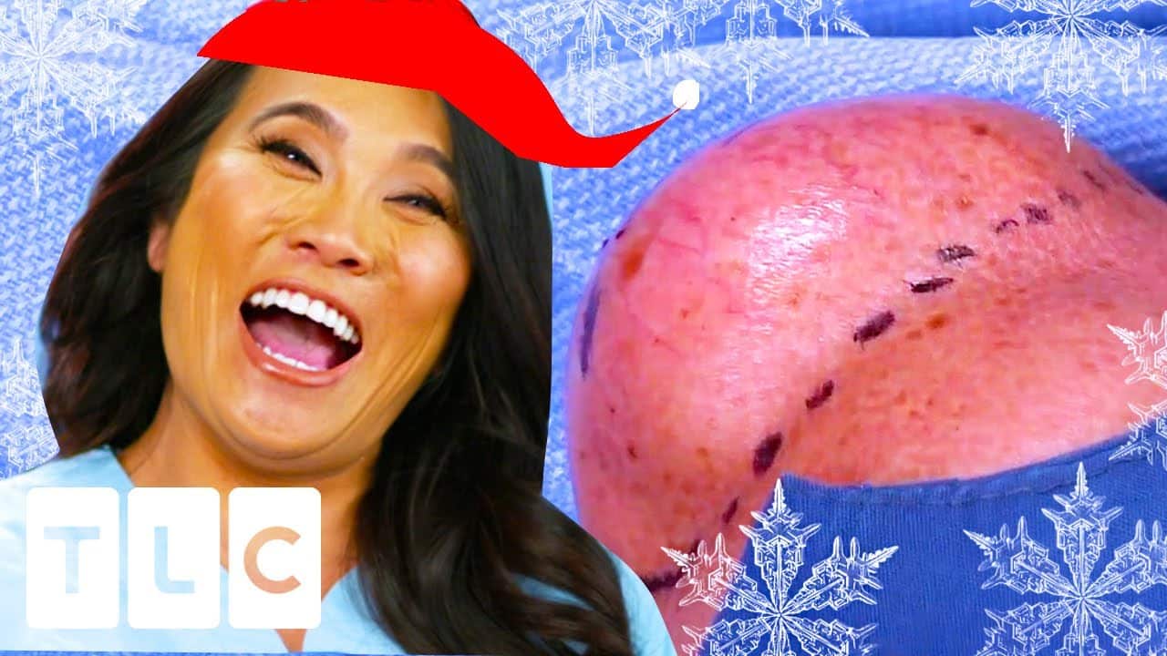 Merry CYST-mas: The Most Delicious Cyst Pops | Dr. Pimple Popper