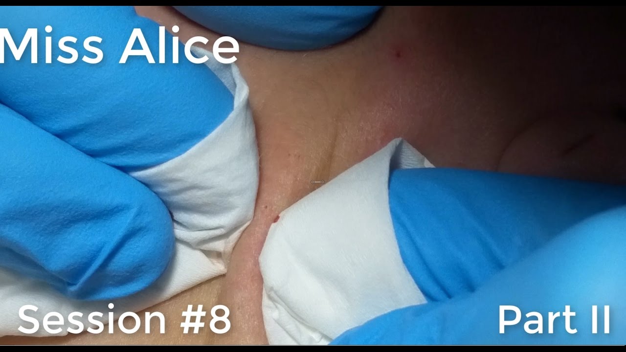 Miss Alice: Session #8 – Part 2 (of 3)