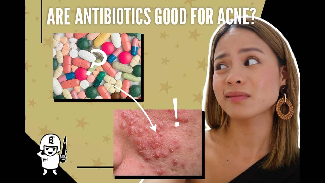 My Experience With Antibiotics For Acne ( Pros and Cons )