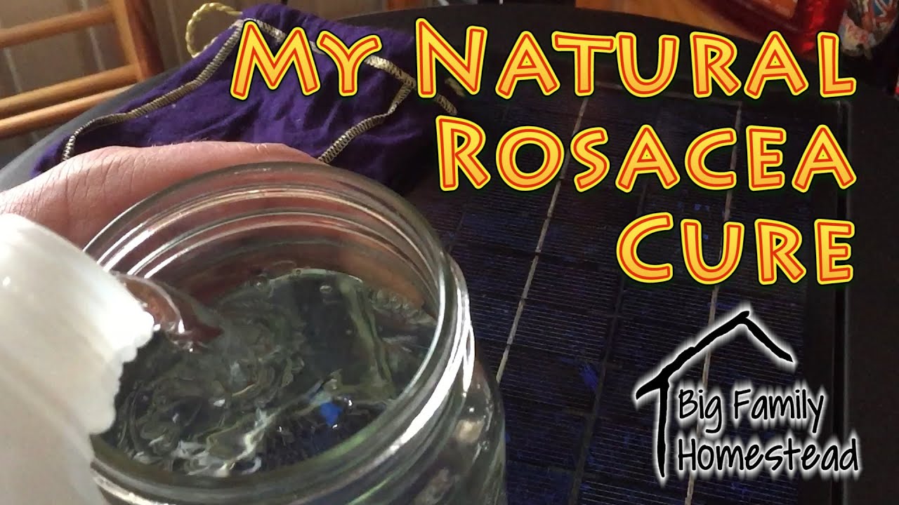 My Natural Rosacea Treatment