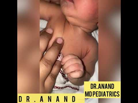 Neonatal pustular melanosis ( Pediatric Dermatlogy By Dr.Anand )
