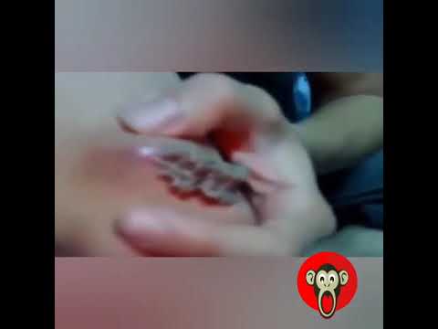 OMG! PIMPLE POPPING 2020 ? Warning ⚠️ Blackheads removal   Cyst   wound   abscess   don't puke