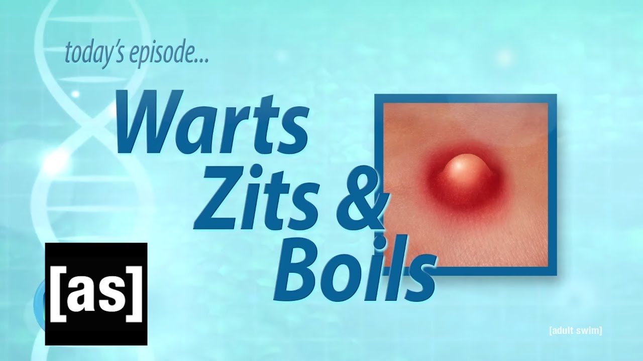 Our Bodies: Zits, Boils & Lesions | Channel 5 | adult swim
