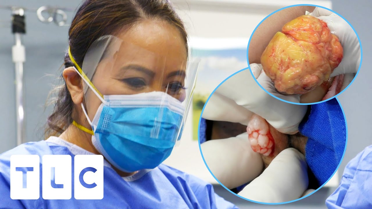 Over 8 Minutes Of Satisfying Popping! | Dr. Pimple Popper