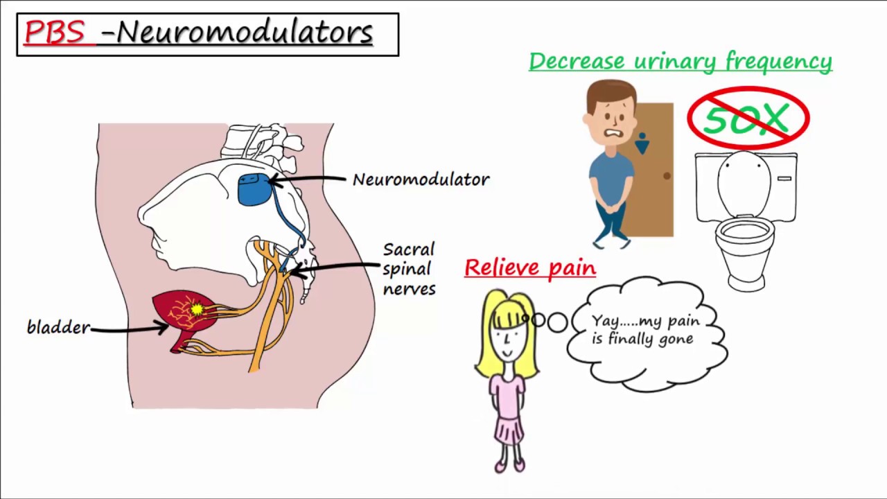 Painful Bladder Syndrome (PBS) / Interstitial Cystitis (IC)