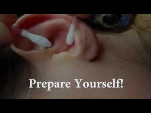 Pimple In Ear Exploded’s, Very satisfying sound. part 1