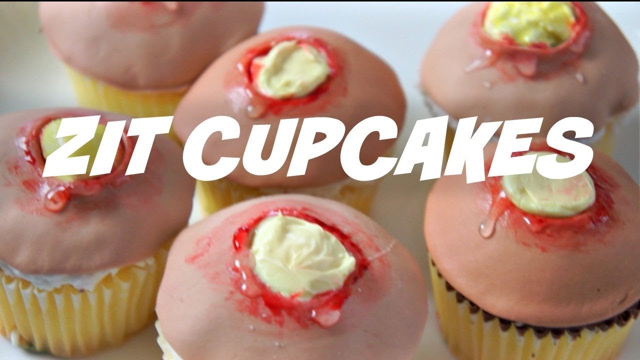 Pimple Popper Cakes?  Zits, Acne & Popping for Popaholics ?