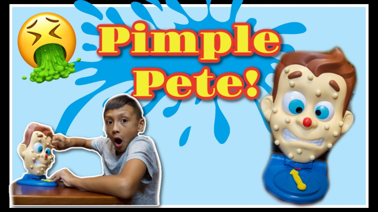 PIMPLE POPPING CHALLENGE!! *PIMPLE PETE*