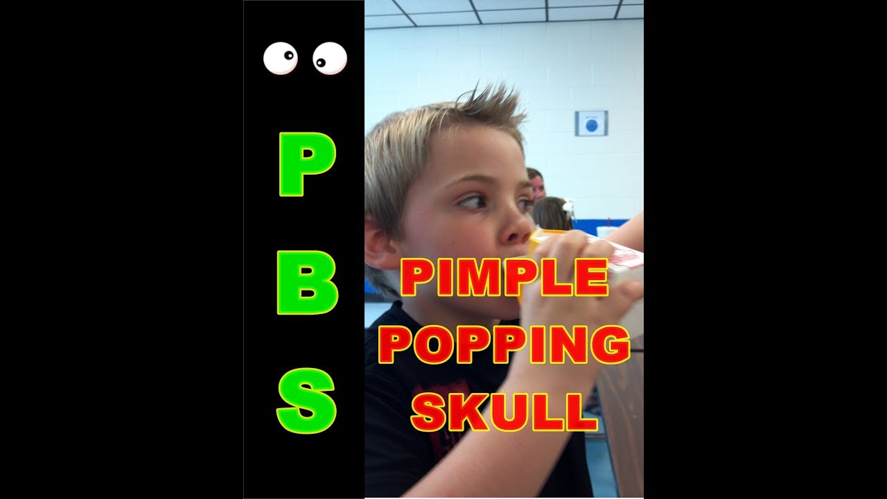 Pimple popping fun?  GROSS!