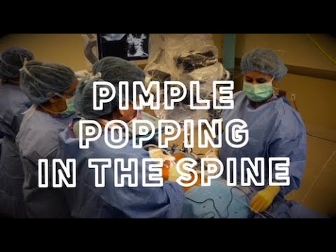 Pimple Popping in the Spine (Oddly Satisfying)