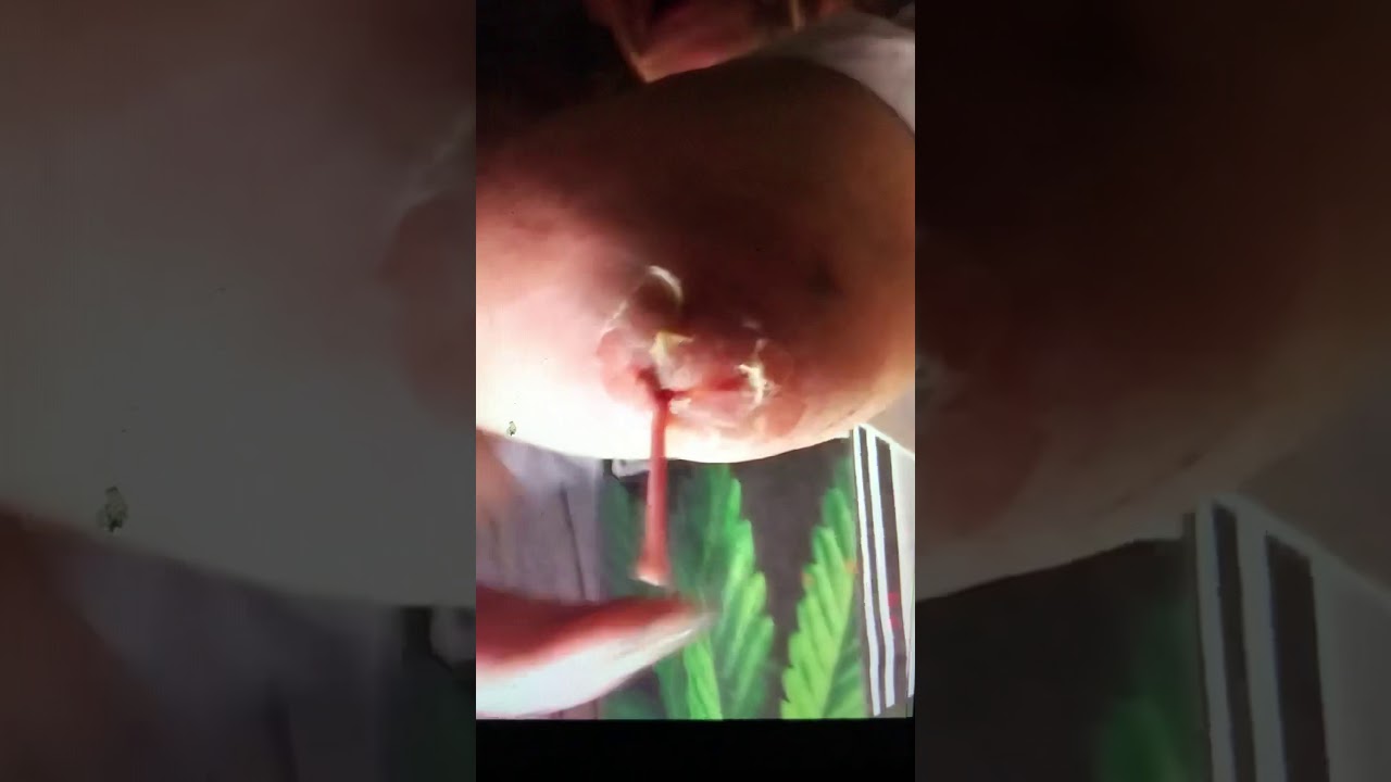 Pimple popping pussy mess out
