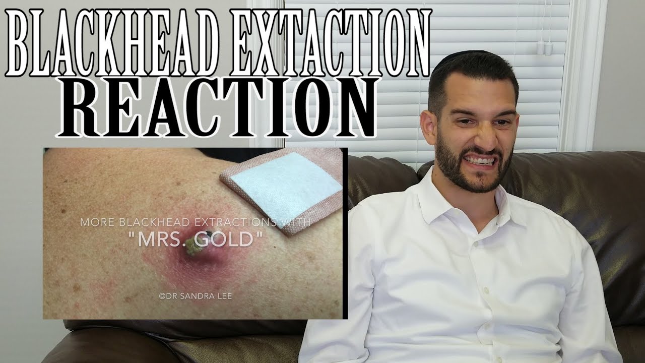 Pimple Popping Reaction!