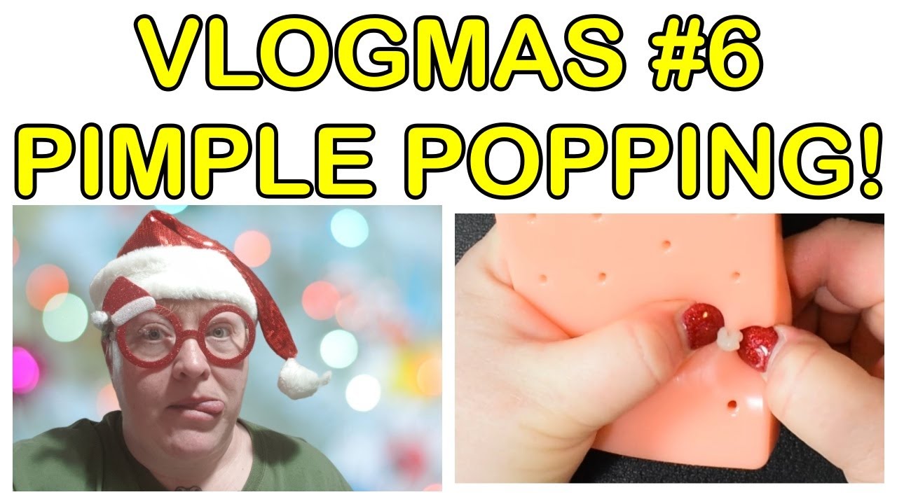 Pimple Popping Stress Toy (Pimple Picker) – VLOGMAS 2019 #6