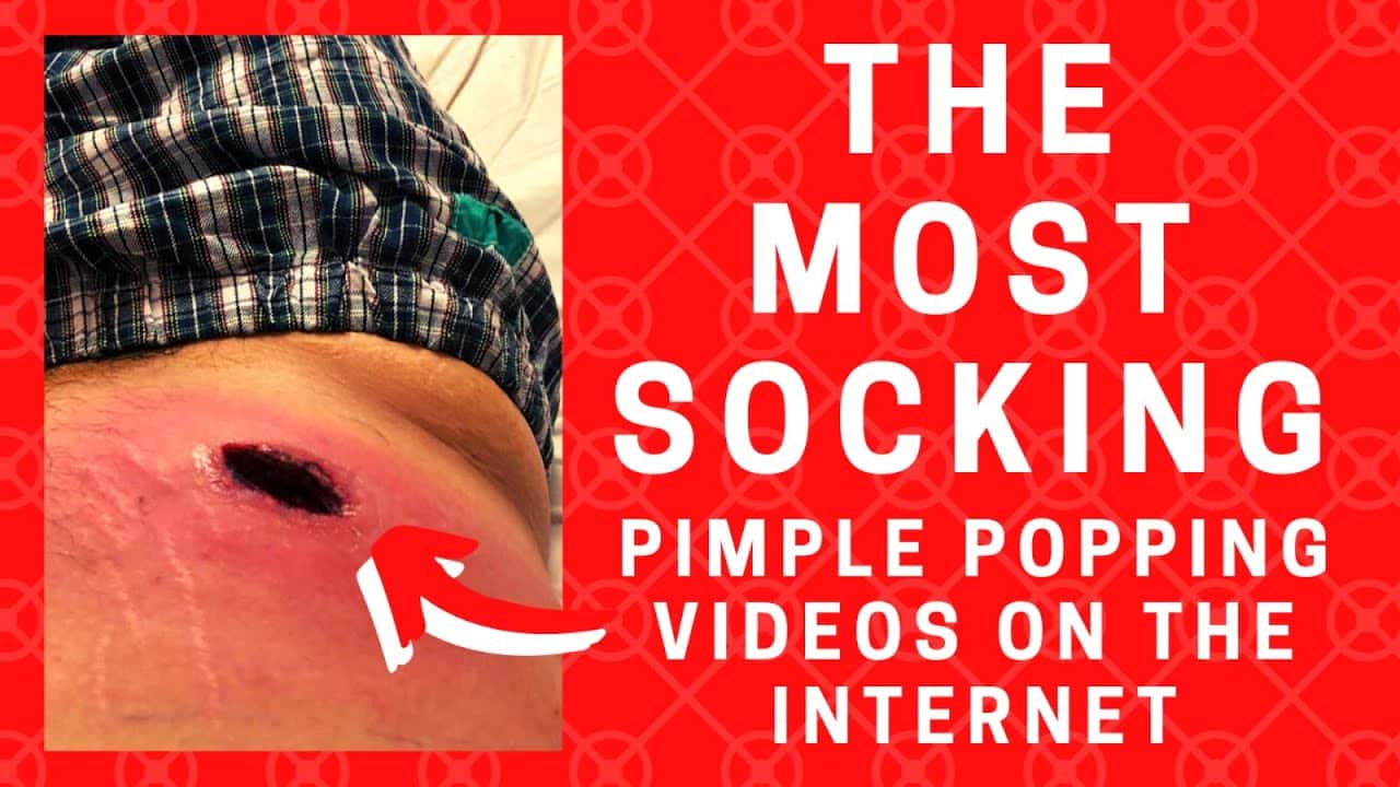 Pimple Popping – The Most Socking Pimple Popping Videos on the Internet