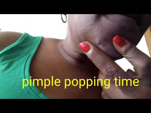 Pimple popping,on chin