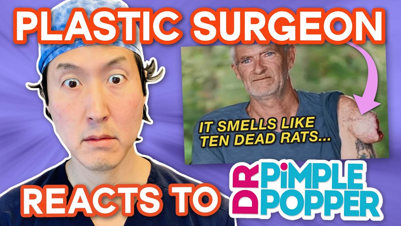 Plastic Surgeon Reacts to DR. PIMPLE POPPER! MASSIVE Arm Growth?!?! – Dr. Anthony Youn