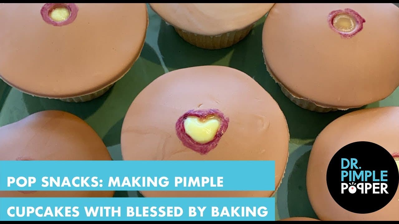 POP SNACKS: Making Pimple Cupcakes with Dr. Pimple Popper & Blessed By Baking!