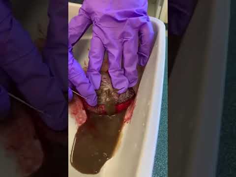 Popping a cyst – Veterinary Video