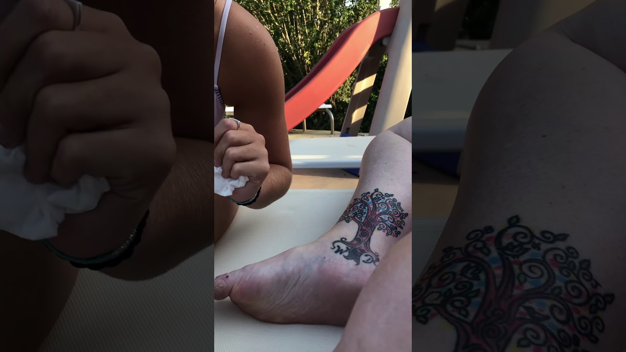 Popping my Aunts ganglion cyst
