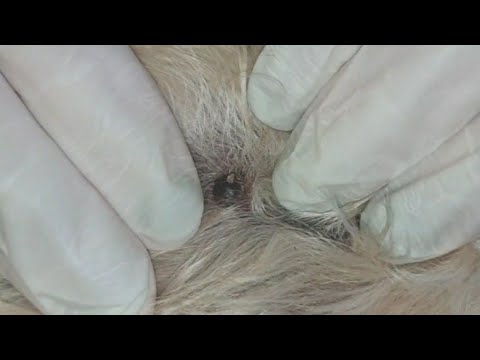 Popping SEBACEOUS CYST on a dog