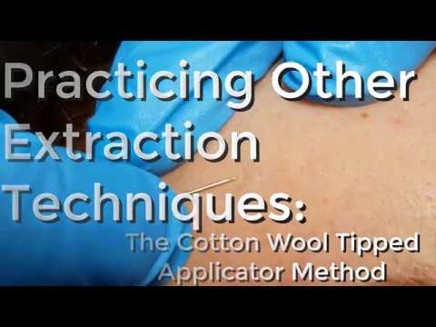 Practicing other extraction techniques – Cotton wool tipped applicator