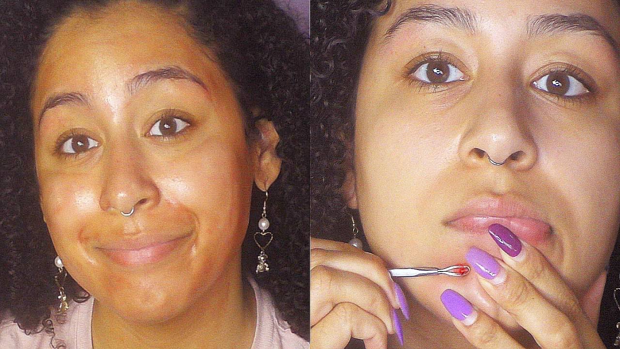 QUARANTINE SELF CARE: Pimple Popping, The Ordinary AHA + BHA Peeling Solution, Eyebrow Tweezing