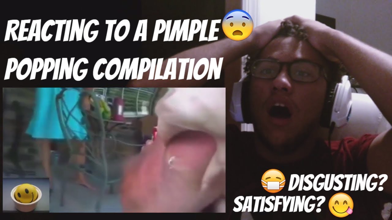 Reacting To a Pimple Popping Compilation Flying Pimples Huge Nasty Cysts
