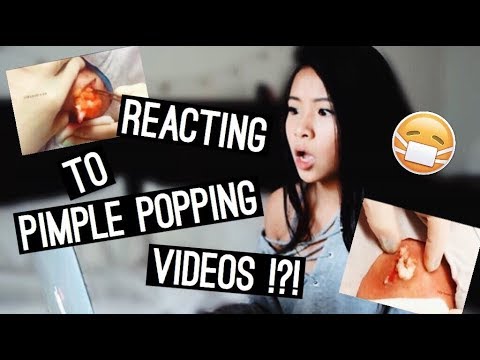 REACTING TO GROSS PIMPLE POPPING VIDEOS!!