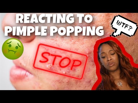 REACTING TO NASTY PIMPLE POPPING ?