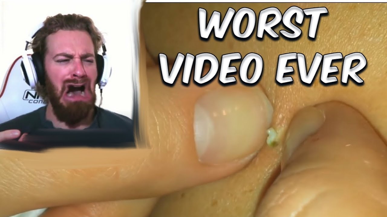 REACTING TO  ZIT POPPING VIDEOS